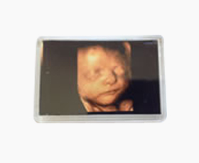 Ultrasound pic fridge magnet