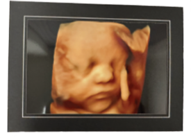 Large Photo in a Frame