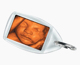 Ultrasound picture key ring