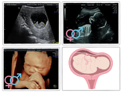 Bump2Baby Multi Scan Package