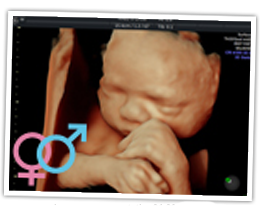 dating scan