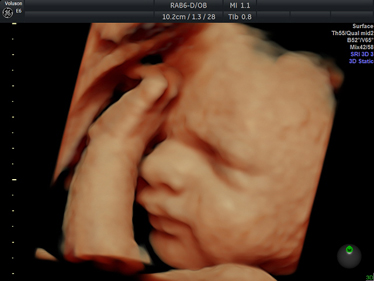 4D Scan Image