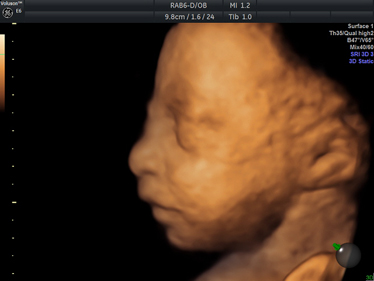 4D Scan Image