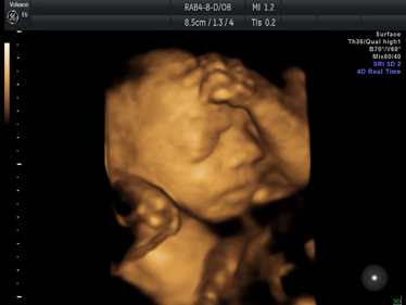 4D Scan Image
