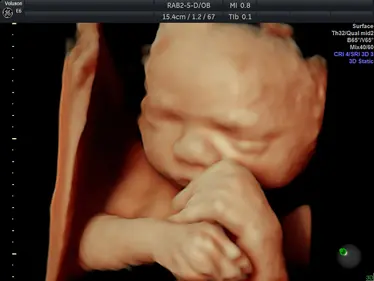 4D Scan Image