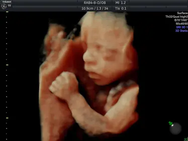 4D Scan Image