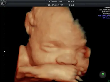 4D Scan Image