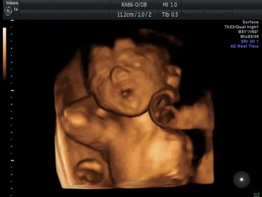 4D Scan Image