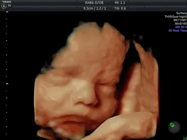 4D Scan Image