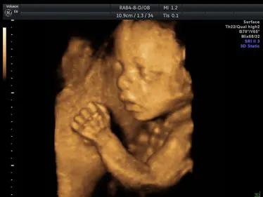 4D Scan Image