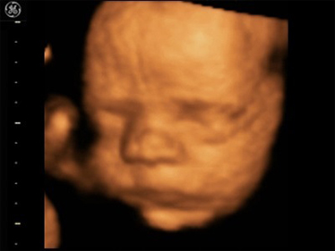 4D Scan Image