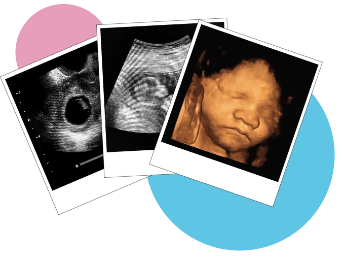 Scans Throughout Pregnancy