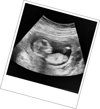 Date & Wellbeing Scan