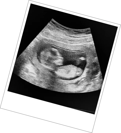 Date & Wellbeing Scan