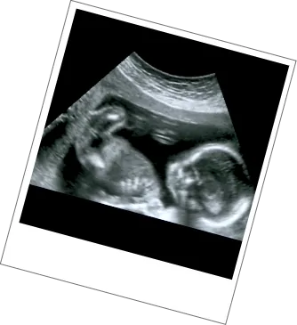 Date & Wellbeing Scan