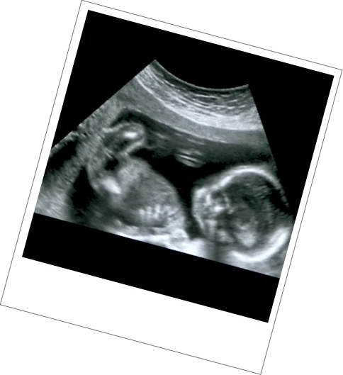 Growth & Wellbeing Scan