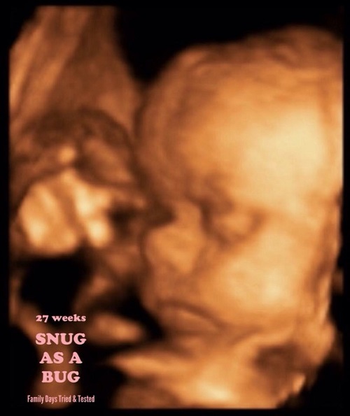 4D baby scan