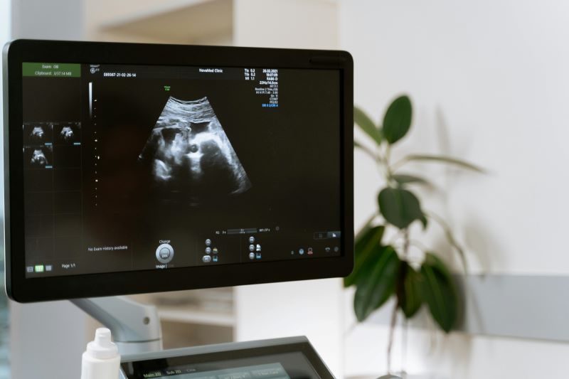 Do I Need a Referral for a Private Ultrasound?