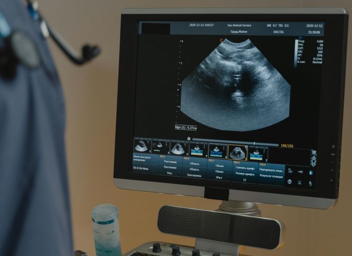 Ultrasound pregnancy scan