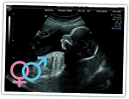 2D baby scan