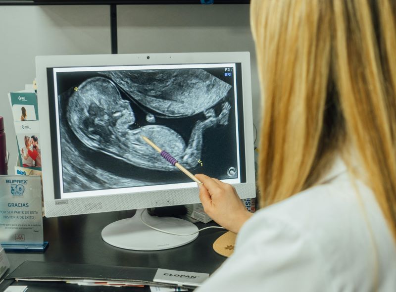 Are Private Ultrasounds Safe?