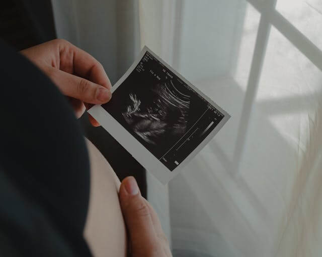 pregnant woman holding an ultrasound scan photo