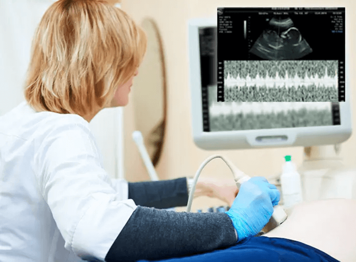 16 week ultrasound scan