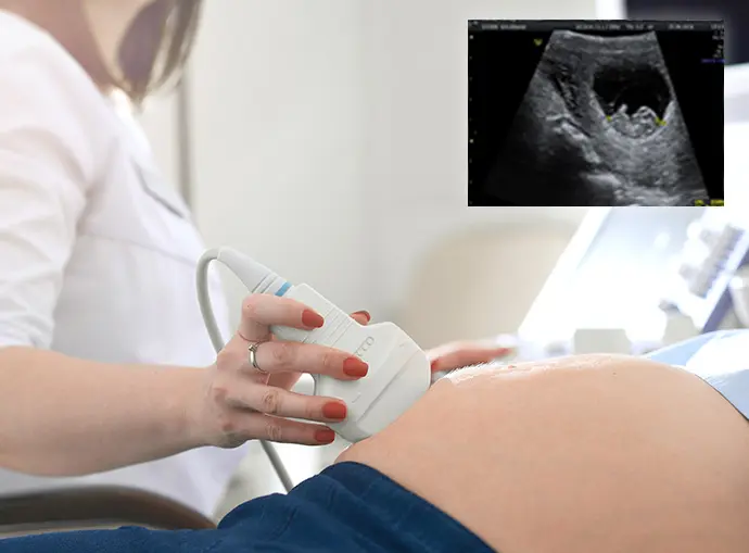 Why have an early pregnancy scan?