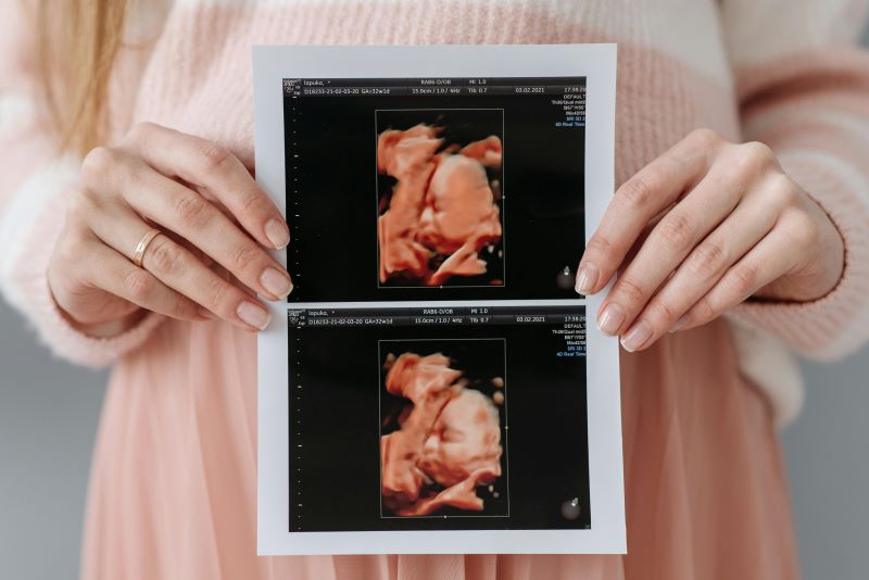 What’s the Latest You Can Have a 4D Scan?