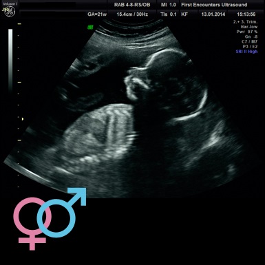 Baby gender scan