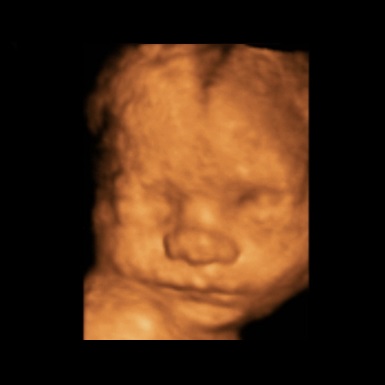 4D baby scan